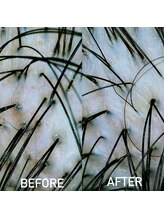 モモ 札幌(MOMO.)/ヘッドスパ後の毛穴の状態