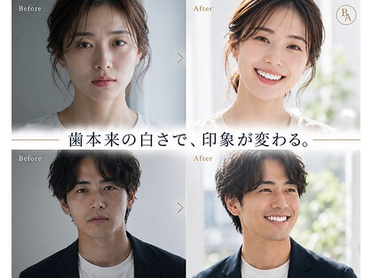 ホワイトニングサロン　ブラン・アトリエ　石橋店の写真