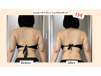 シーエーピーリュクス(C A P LUXE)の写真