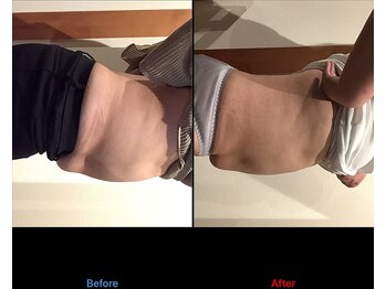 サロン ココ(COCO)/次世代EMS グランテスラ