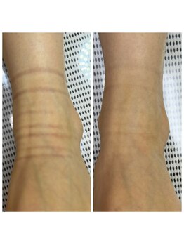 ドクターネイル爪革命 十条店/アロマフットリフレ