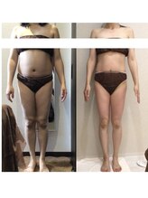 ボディベルム(BODY BELM)/産後太りの方に