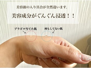 アルティ 福岡大名店(ARTI,)/イオン導入120倍の効果☆