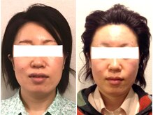 美容整体ウェリナ あま甚目寺院/小顔矯正/骨盤矯正/美脚サロン