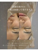 ヒュウ(hue.)/韓国発最新肌管理[セルマン]