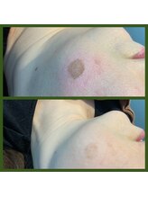 マルサンカクシカク(○△□)/