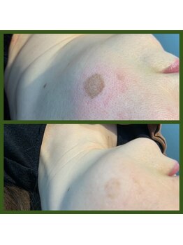 マルサンカクシカク(○△□)/