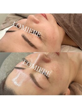 ロミエール 南草津店(LOMIERE)/セルマン★ツヤ肌/ 11000