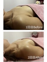 チュラ 大宮店(Chura)/【40代】バストアップ2回目@大宮