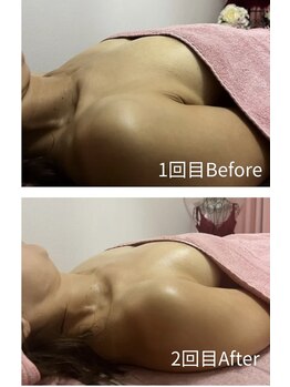 チュラ 大宮店(Chura)/【40代】バストアップ2回目@大宮