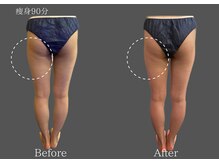 クレビア 麻布十番(CREBIA)の雰囲気（痩身ラフォスで美脚&美尻が叶う♪）