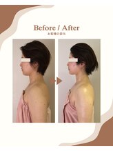 ビーキュート 学芸大学店(BE-CUTE)/Before/After　施術