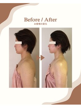 ビーキュート 学芸大学店(BE-CUTE)/Before/After 施術