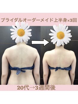 スワン 新栄店(SWAN)/他サロンで満足されず…駆け込み