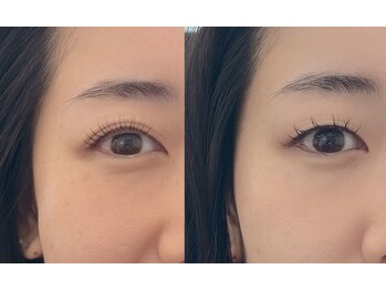 リコット バイ カシータ(Recot by casita)の写真/【瞼にアプローチ】特殊技術で瞼のリフトアップを叶えます。目元がスッキリした仕上がりに！