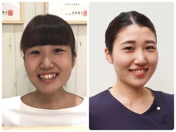 コルギ専門店 マキシフォート 栄店(Maxifort)/スタッフ澤木♪