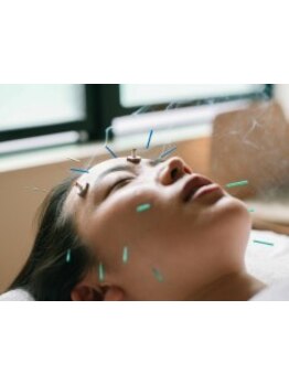 鍼灸施術を受けたい