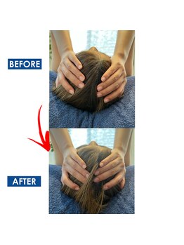 リアン(Liam)/小顔矯正/頭蓋骨矯正