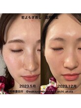 マロカ(Marroka)/【バラエティ蒸しの結果7】