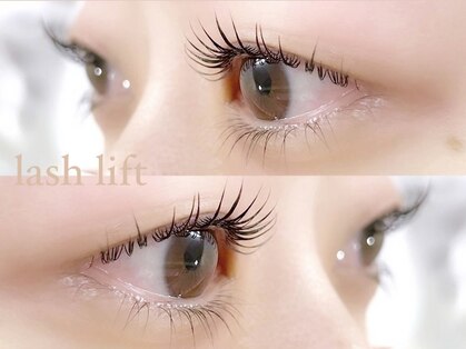 アミル(amiLe)の写真