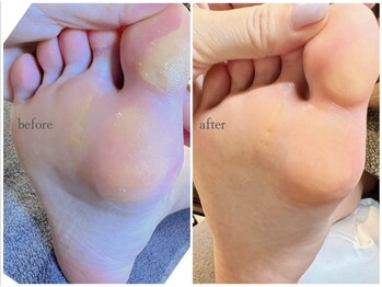 ロッタ(Lotta)/foot care.