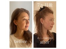 スパ 香炉の雰囲気（人気No.1施術最新美容機器【ギノーVARフェイシャル】）