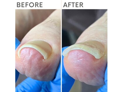 クオッカ(Quokka)の写真