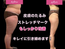 グラシアス サロン(GRACIAS SALON)の雰囲気（before→afterフォトをご参考に是非ご覧下さい☆）