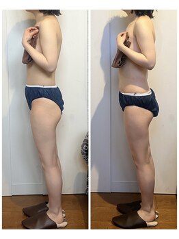 バンブー B2 新涯店(Bamboo)/筋膜リリース1回