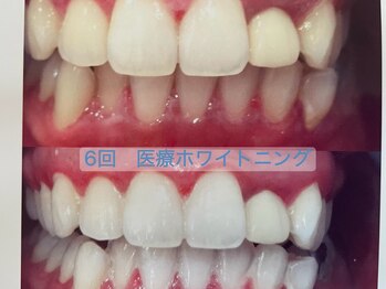 シャイニー 掛川店(shiny)/