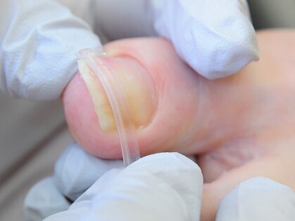 巻爪レスキュー 尼崎の写真