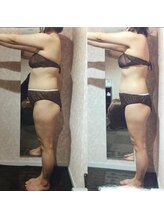 パーフェクトボディプレミアム 札幌駅前店(PERFECT BODY PREMIUM)/お客様　ビフォーアフター（4）