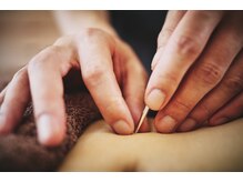 鍼灸治療院 森空堂 本院/「刺さない鍼」もあります！