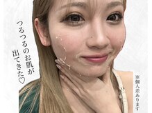 ビューティービューティー(beauty×beauty)の雰囲気（他店と比べて下さい！ハーブピーリング自信あり）