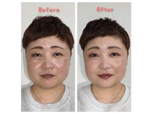 マッティーナ(mattina)の雰囲気（30代/ブルベ夏のお客様　フォトギャラリーに感想や症例多数☆）
