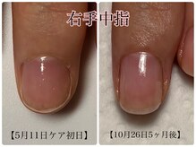 トイロ ネイル(Toiro Nail)の雰囲気（◎素爪ケア◎爪の悩み、トラブル改善しよう！！）