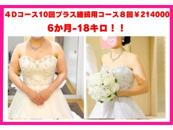 フレクシー/ブライダル痩身