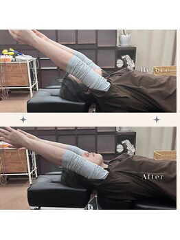 くすの木 治療院/重たい腕