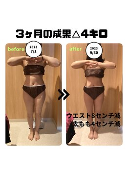 ミルキー(MiLuKy)/痩身Before→After