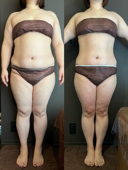 ステラ(Stella)/3ヶ月はアッという間☆