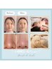 【限定】第一印象UPに◎【小顔矯正×毛穴洗浄】人気コンビで即実感憧れ小顔へ