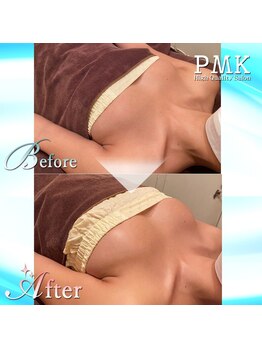 PMK ルグラン 難波店(Le Grand)/バスト1回施術