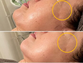 プライベートエステティックサロン クール(Coeur)/【光de透明美白コース】