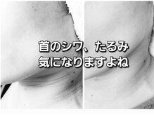 シェリングの雰囲気（しわたるみ改善!エイジングケアで顔のシミケア/むくみうれい線◎）