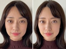 垢抜け感UP◎お客様施術Before＆After