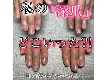 シェリーネイル(che'rie nail)
