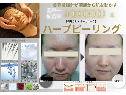エングロー(Englow)の写真