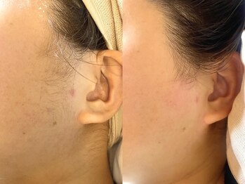 モア30(more30)/【ビフォーアフター】