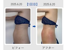 ネオボディ(Neo Body)/疲れやすい身体を改善したい！