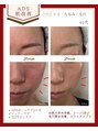 リュミエール(Lumiere) 40代スピーディーに肌改善!たるみシミ改善美肌を目指してます